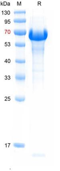 Recombinant NDV HN protein, His