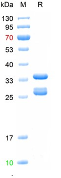 Recombinant human PTH protein