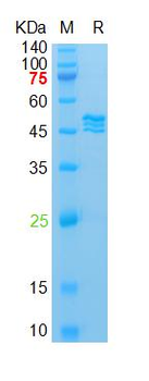 Recombinant SARS-Cov-2 N protein (del204, del215), His