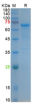 Recombinant SARS-Cov-2 N & RBD protein, His