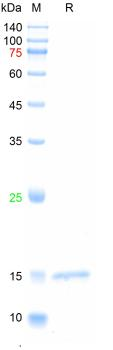 Recombinant Dengue protein (genotype 1/2/3/4, contains 13 immuno-reactive epitpes)