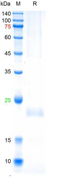 Recombinant HBsAg protein