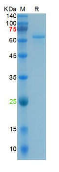 Recombinant human ACE2 protein, His