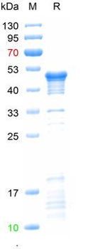 Recombinant human DDR2 protein, N-His
