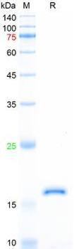 Recombinant human ASC protein, His