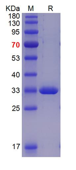 Recombinant human S100-A8/A9 protein, His