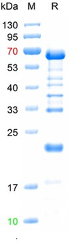 Recombinant human TNIC (complex) protein, Trx & S & His