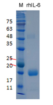Recombinant human IL-6 protein, C-His