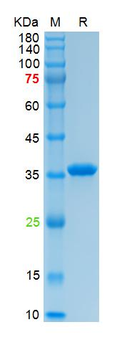 Recombinant human Annexin V protein, N-His