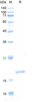Recombinant mouse IL-2 protein, N-His