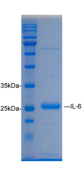 Recombinant mouse IL-6 protein, C-His