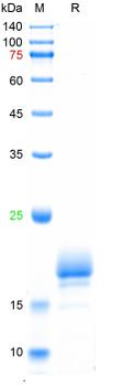 Recombinant human Ki-67 protein, C-His
