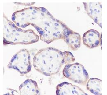 CD47 Recombinant Rabbit Monoclonal Antibody
