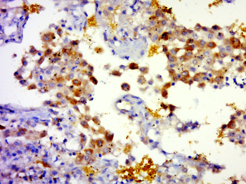 KLHL36 Rabbit Polyclonal Antibody