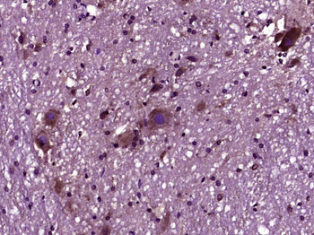 Laminin 2 alpha Rabbit Polyclonal Antibody