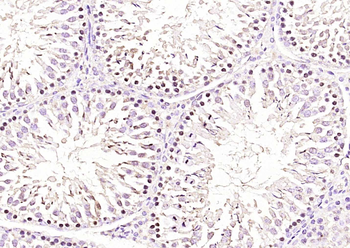 RNF138 Rabbit Polyclonal Antibody