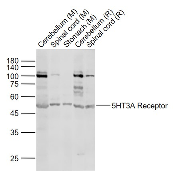 5HT3A Receptor Rabbit Polyclonal Antibody