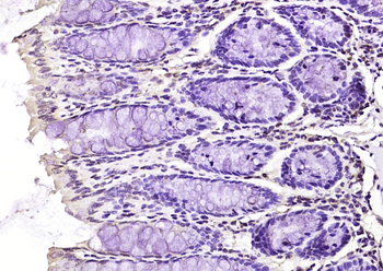 ABH1 Rabbit Polyclonal Antibody