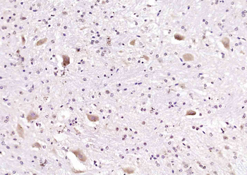 ABLIM3 Rabbit Polyclonal Antibody