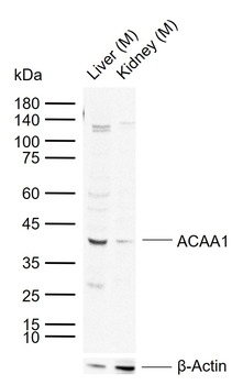 ACAA1 Rabbit Polyclonal Antibody