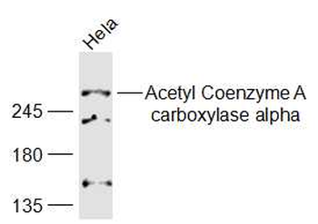 ACACA Rabbit Polyclonal Antibody