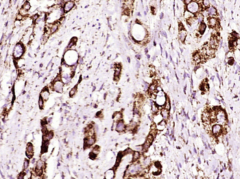 Phospho-ADAM17 (Thr735) Rabbit Polyclonal Antibody