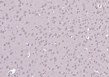 ADRM1 Rabbit Polyclonal Antibody
