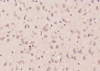 Advillin Rabbit Polyclonal Antibody