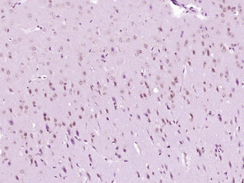 Phospho-AKT3 (Tyr473) Rabbit Polyclonal Antibody