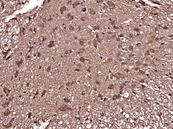 Phospho-alpha B Crystallin (Ser59) Rabbit Polyclonal Antibody