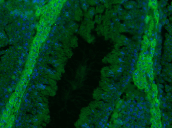 GAA Rabbit Polyclonal Antibody