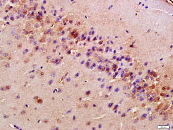 Alpha-synuclein (nitro-Tyr39) Rabbit Polyclonal Antibody