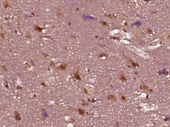 Phospho-AR/Androgen receptor (Ser515) Rabbit Polyclonal Antibody