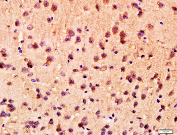 ANKK1 Rabbit Polyclonal Antibody