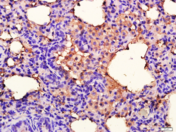 ANKK1 Rabbit Polyclonal Antibody