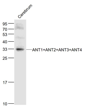 ANT1+ANT2+ANT3+ANT4 Rabbit Polyclonal Antibody