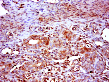 RNF14 Rabbit Polyclonal Antibody
