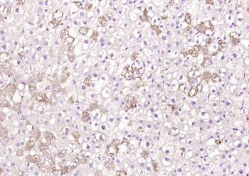 ApoM Rabbit Polyclonal Antibody