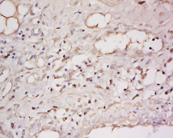 Phospho-ATF2 (Thr69 / Thr51) Rabbit Polyclonal Antibody