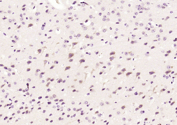 Phospho-ATF2 (Thr73 / Thr55) Rabbit Polyclonal Antibody
