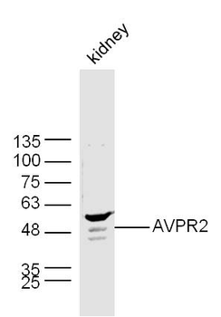 AVPR2 Rabbit Polyclonal Antibody