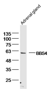 BBS4 Rabbit Polyclonal Antibody