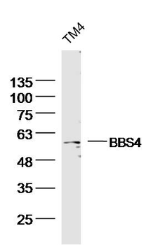 BBS4 Rabbit Polyclonal Antibody