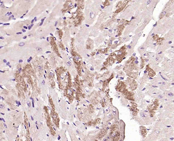 BBS9 Rabbit Polyclonal Antibody