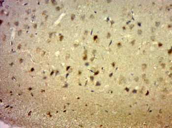 Phospho-Bcl-xL (Thr47) Rabbit Polyclonal Antibody