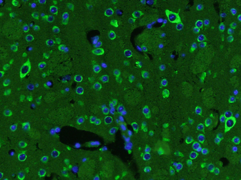 BDNF Rabbit Polyclonal Antibody
