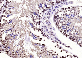 BPTF Rabbit Polyclonal Antibody