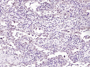 Phospho-BRAF (Ser729) Rabbit Polyclonal Antibody