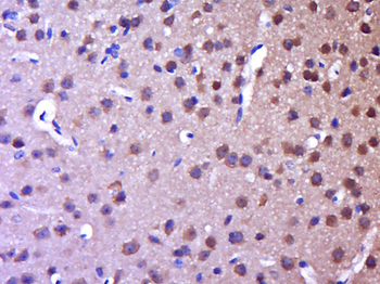 BRSK2 Rabbit Polyclonal Antibody