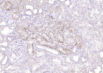 BZW1 Rabbit Polyclonal Antibody
